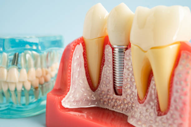 Our Range of Dental Services in Granger, TX